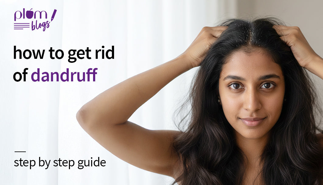 How To Get Rid Of Dandruff: 10 Home Remedies That Work