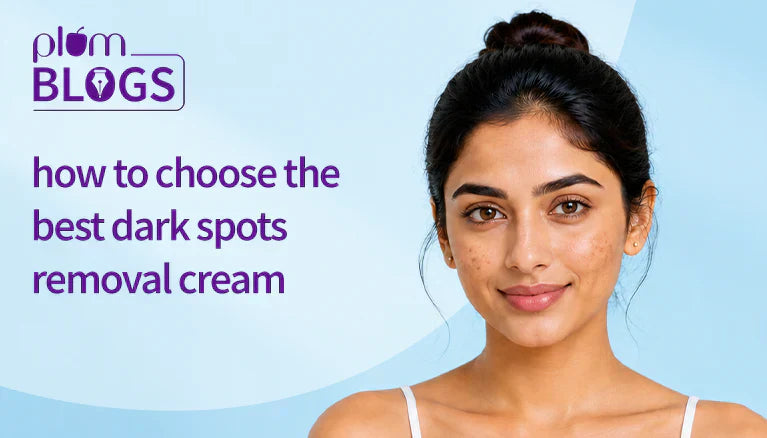 Everything You Need to Know Before Buying a Dark Spot Remover Cream