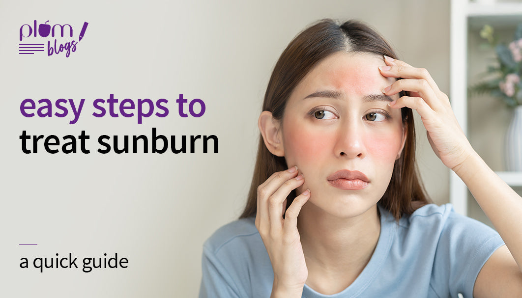 Sunburn on the face - caution, precaution, and treatment