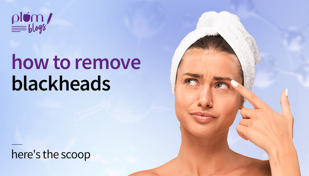 How to remove blackheads