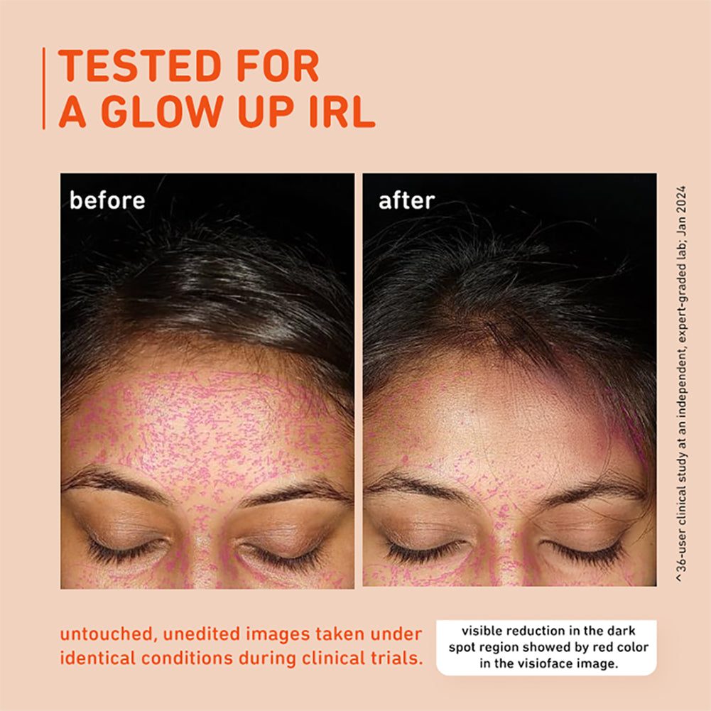 15% Vitamin C & Mandarin Glow Boost Serum
