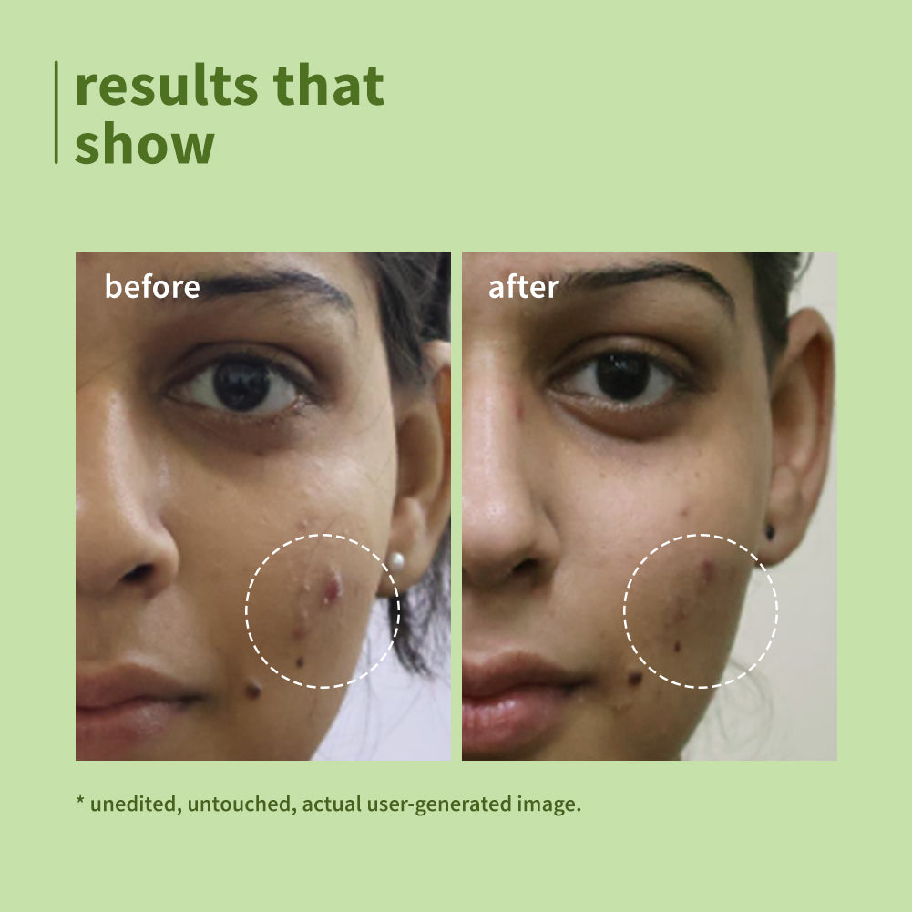 Green Tea Pore Cleansing Face Wash for Acne