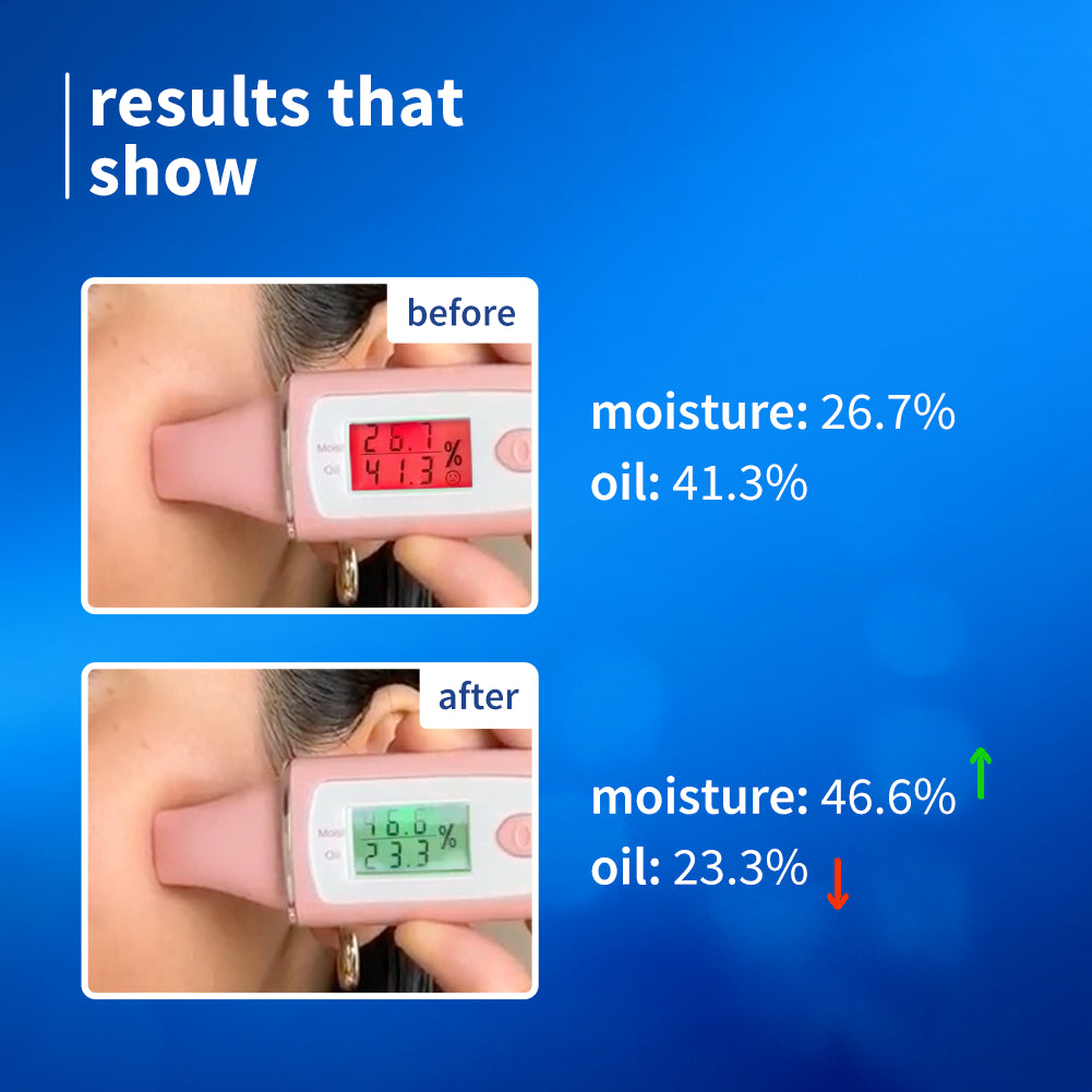 2% Niacinamide & Rice Water Brightening Gel Moisturizer For Clear & Bright Skin