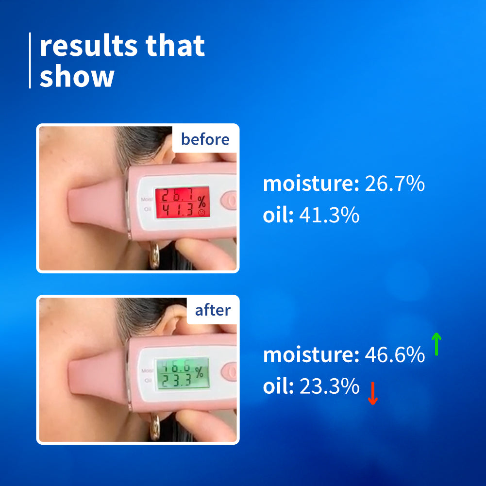 2% Niacinamide & Rice Water Brightening Gel Moisturizer