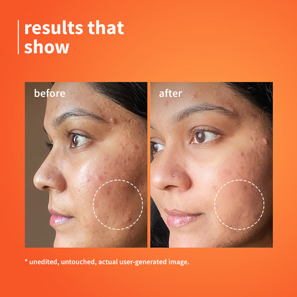 10% Vitamin C & Calendula Barrier Boosting + Glow Serum