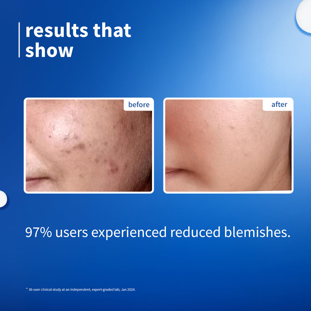 10% Niacinamide & Rice Water Brightening Face Serum For Clear & Bright Skin