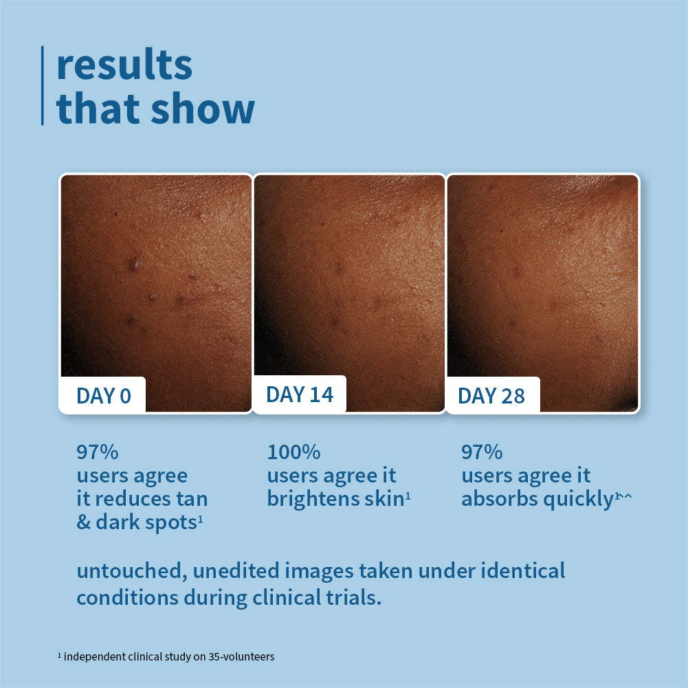 2% Niacinamide & Rice Water SPF 50 PA+++ Brightening Sunscreen