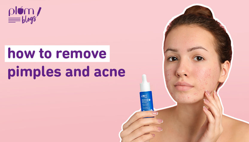 How to Treat Oily & Pimple Skin: Effective Skincare Solutions