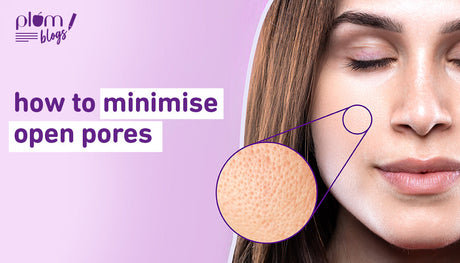 Effective open pores treatment: Minimize enlarged pores for smoother skin