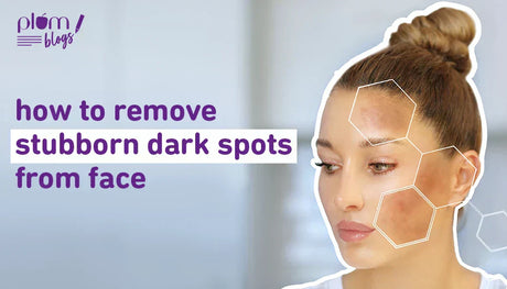 How to get rid of dark spots on the face