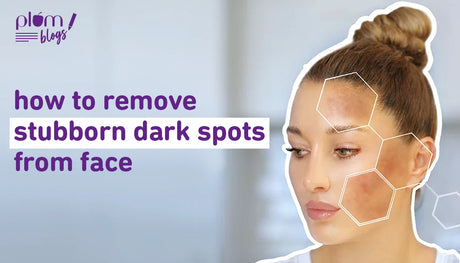 How to reduce dark spots on face : An expert guide