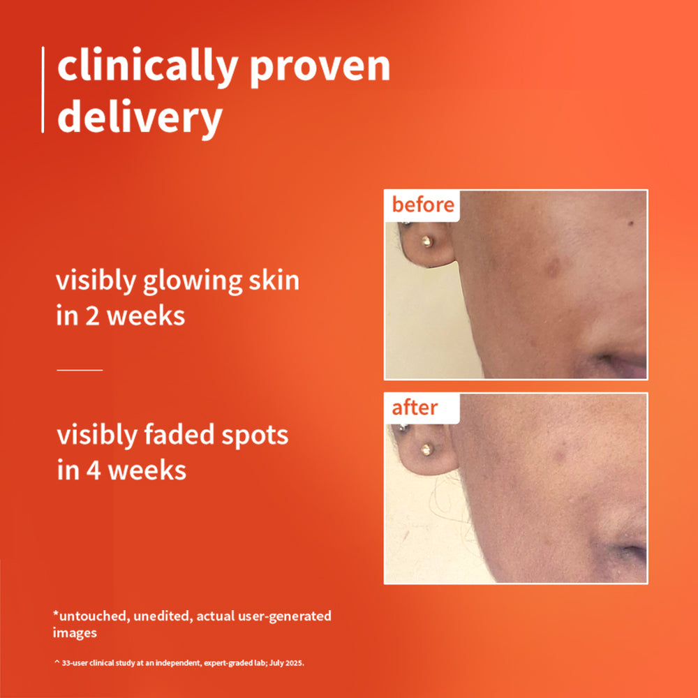1% Vitamin C Ultra-Light-Glow Boosting Gel Cream For Glowing Skin thumbnail 2
