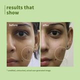 Green Tea Pore Cleansing Face Wash for Acne