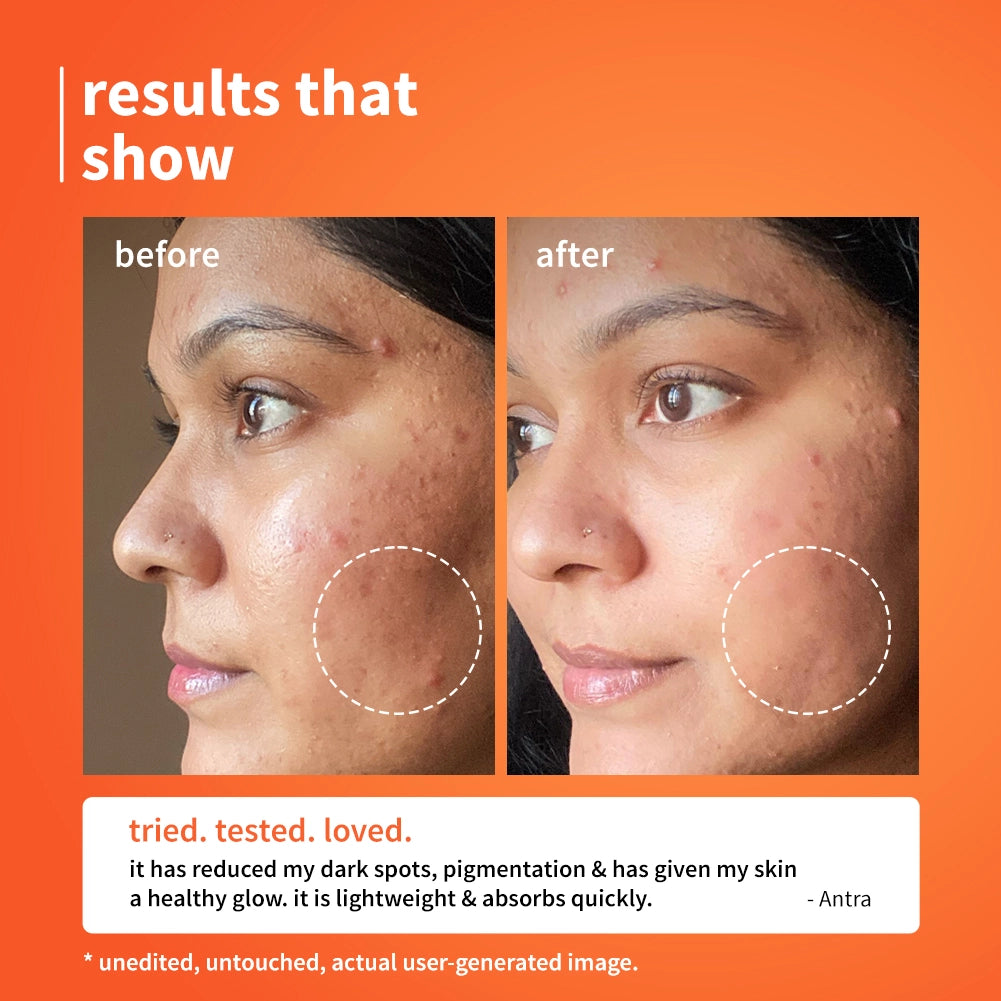 10% Vitamin C & Calendula Barrier Boosting + Glow Serum