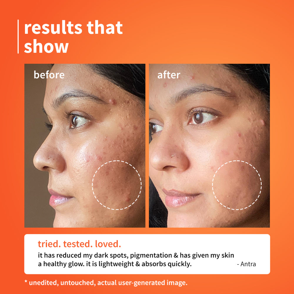 10% Vitamin C & Calendula Barrier Boosting + Glow Serum image 3