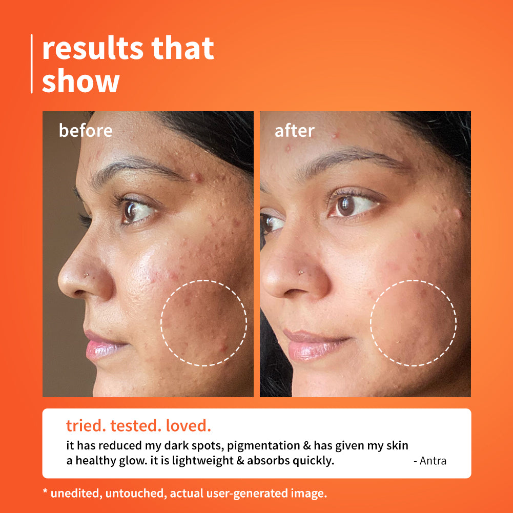 10% Vitamin C Barrier Boosting + Glow Serum with Calendula