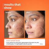 Calendula & 10% Vitamin C Barrier Boosting + Glow Serum