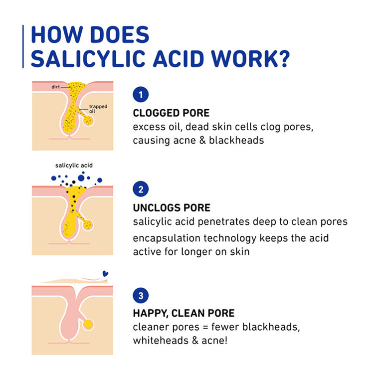 thinkDERMA Salicylic & Lactic Acid Skin-Smoothing Gel Moisturizer | Fights Acne | Improves Skin Texture | Lightweight & Non-Greasy | 100% Vegan