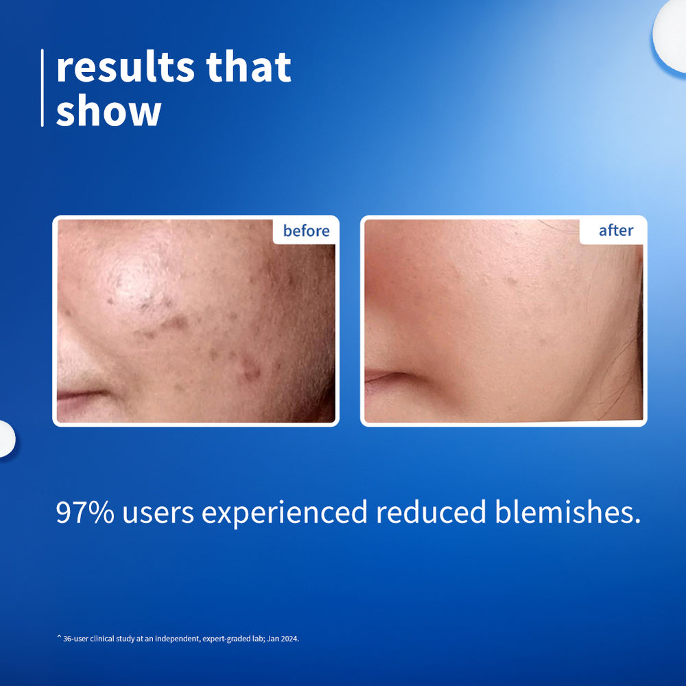 10% Niacinamide & Rice Water Brightening Face Serum For Clear & Bright Skin image 3