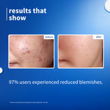 10% Niacinamide & Rice Water Brightening Face Serum