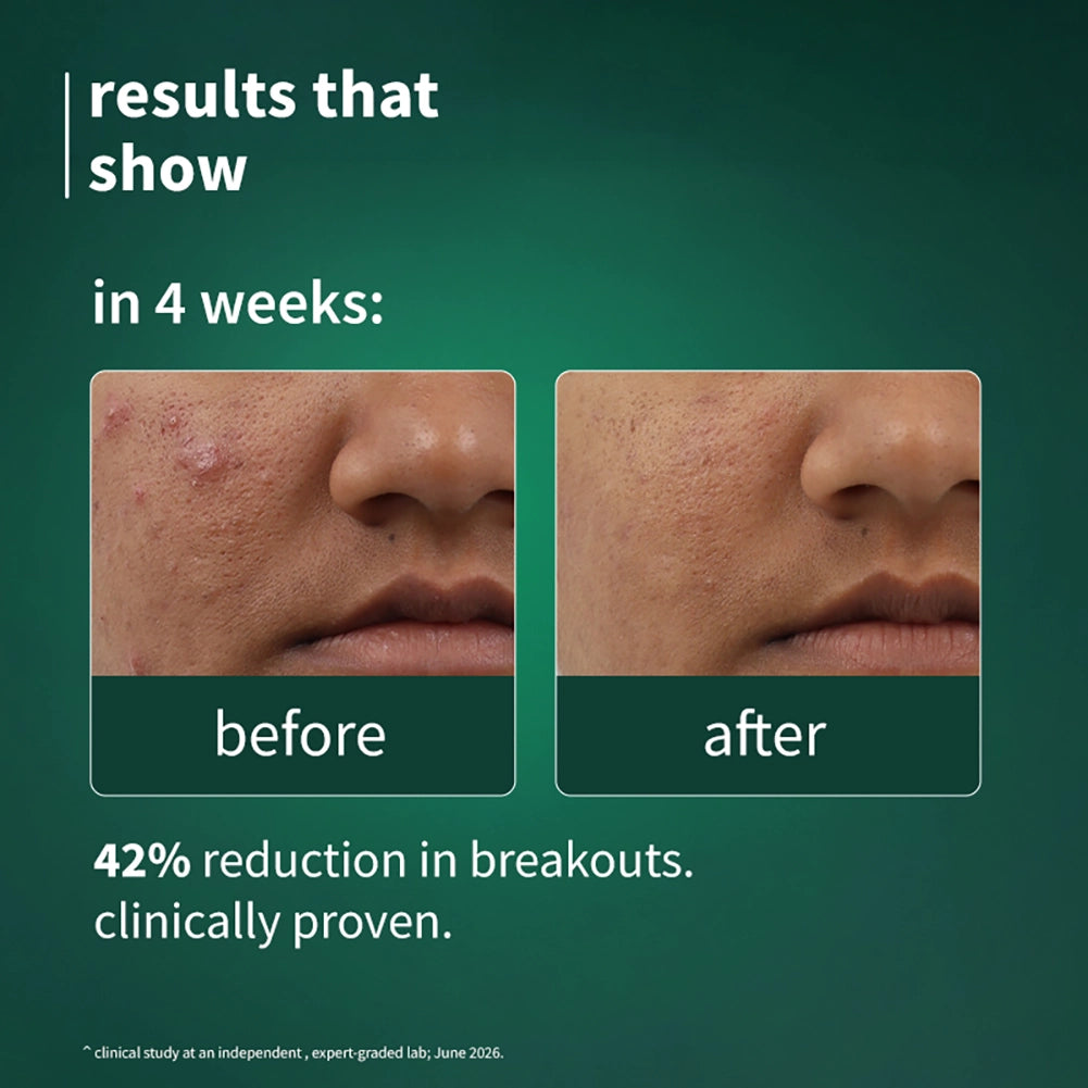 SebaClear™Mattifying Gel Crème with Sebacic Acid & Matcha