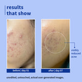 Plum 1% Salicylic Acid Clearly Gentle Gel Face Wash with Blueberry