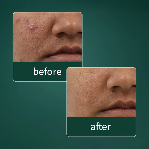 Clinical results