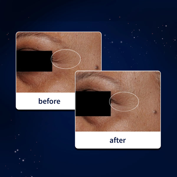 Clinical results