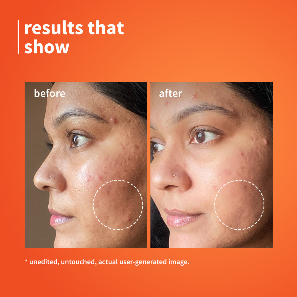 10% Vitamin C Barrier Boosting + Glow Serum with Calendula | 10ml